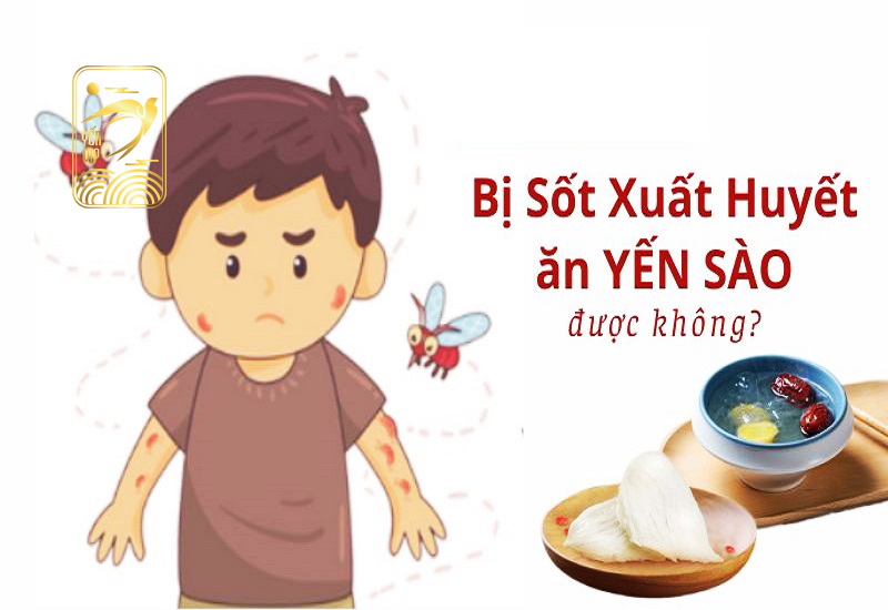 Sốt xuất huyết ăn yến được không